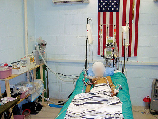 An Afghan boy with a severe head wound in the intensive care ward of the hospital. 